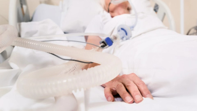 Par mākslīgās plaušu ventilācijas pakalpojuma nodrošināšanu mājās no 1. jūlija
