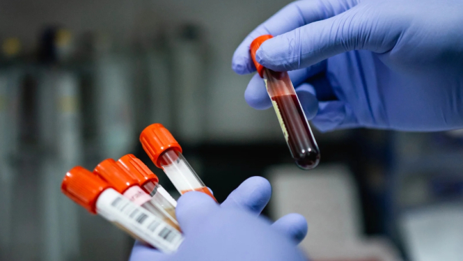 "Centrālās laboratorijas" filiālēs bez maksas var nodot C hepatīta analīzes