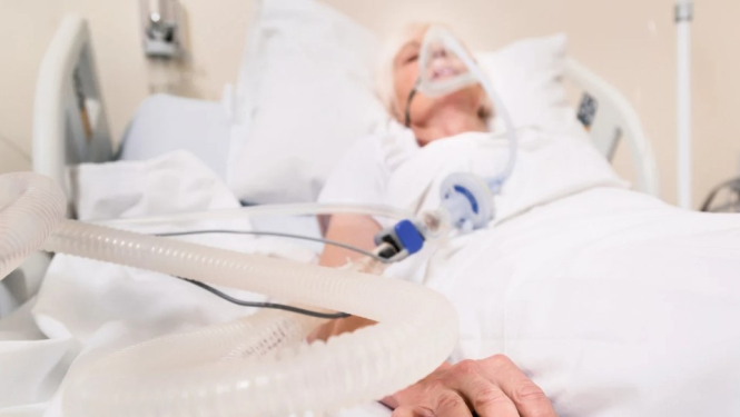 Par mākslīgās plaušu ventilācijas pakalpojuma nodrošināšanu mājās no 1. jūlija