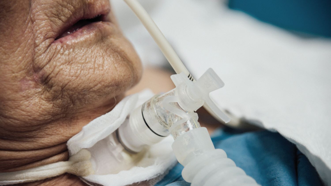 Traheostomas kabinets