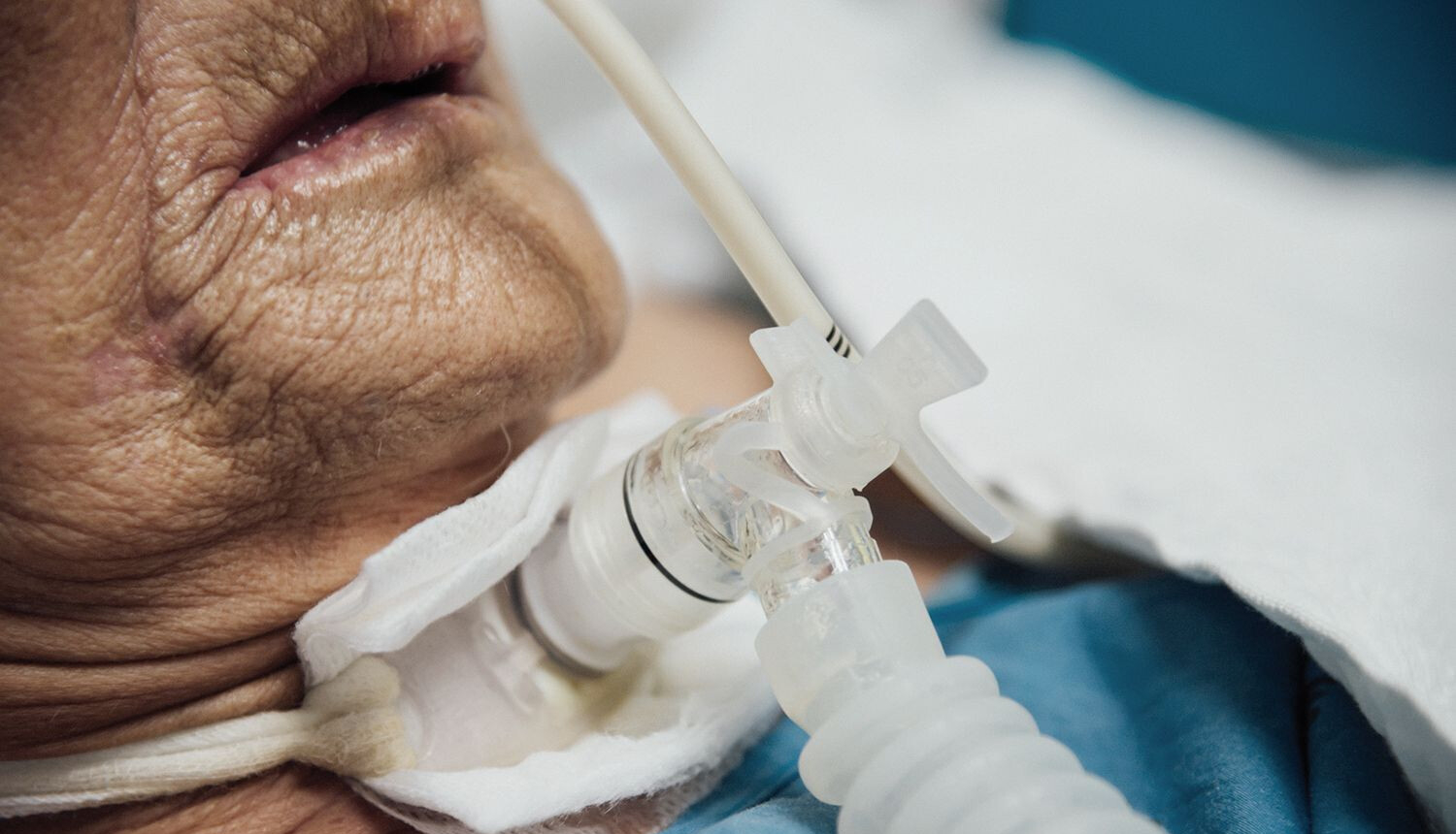 Traheostomas kabinets